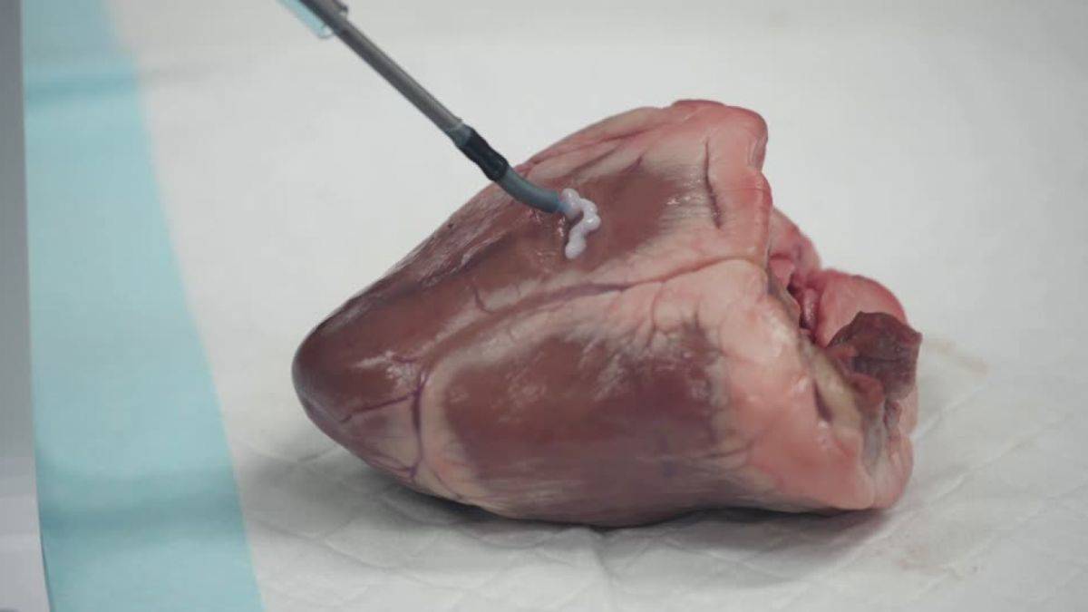 İnsan vücudunda 3 boyutlu organ yazdırma dönemi