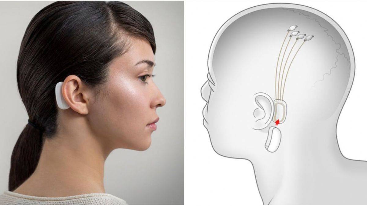 Neuralink projesi: Beyin çipiyle telepati