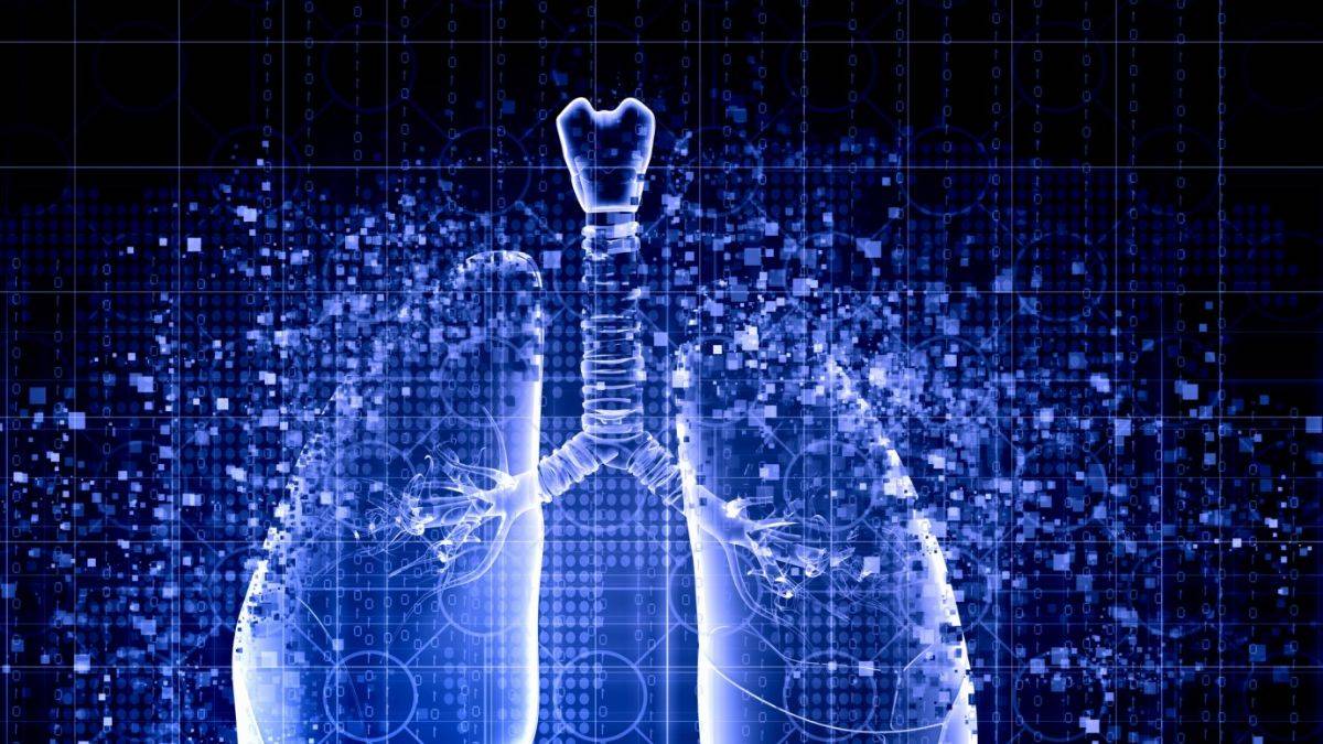 Kanser teşhisinde yapay zeka aracı