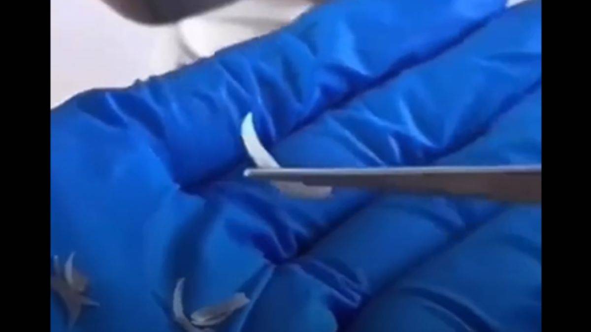 Tırnak yeme alışkanlığı olanlar iyi izlesin