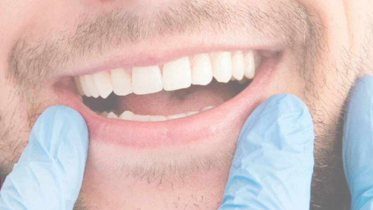 Doku Medikal Diş Beyazlatma