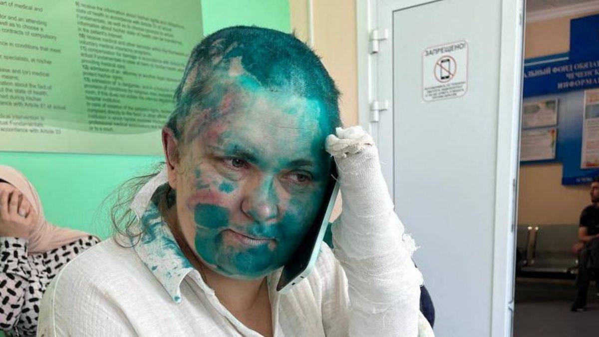 Kadirovcular avukat bıçakladı, gazetecinin parmaklarını kırdı