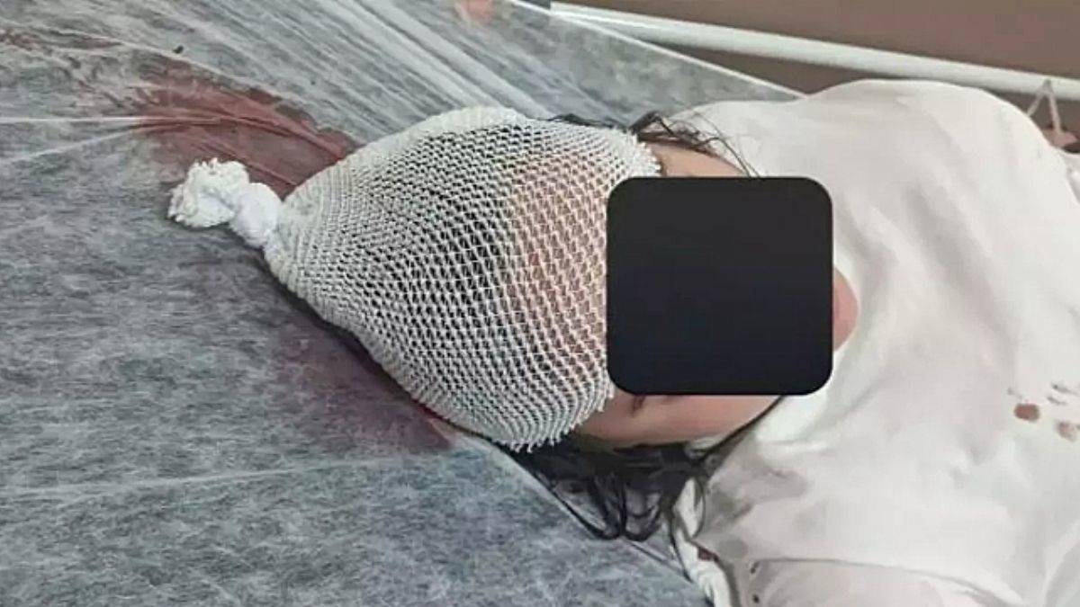 Başıboş köpek saldırısında ağır yaralandı