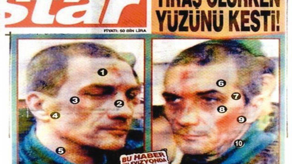 O manşet Yılmaz Özdil'e de soruldu