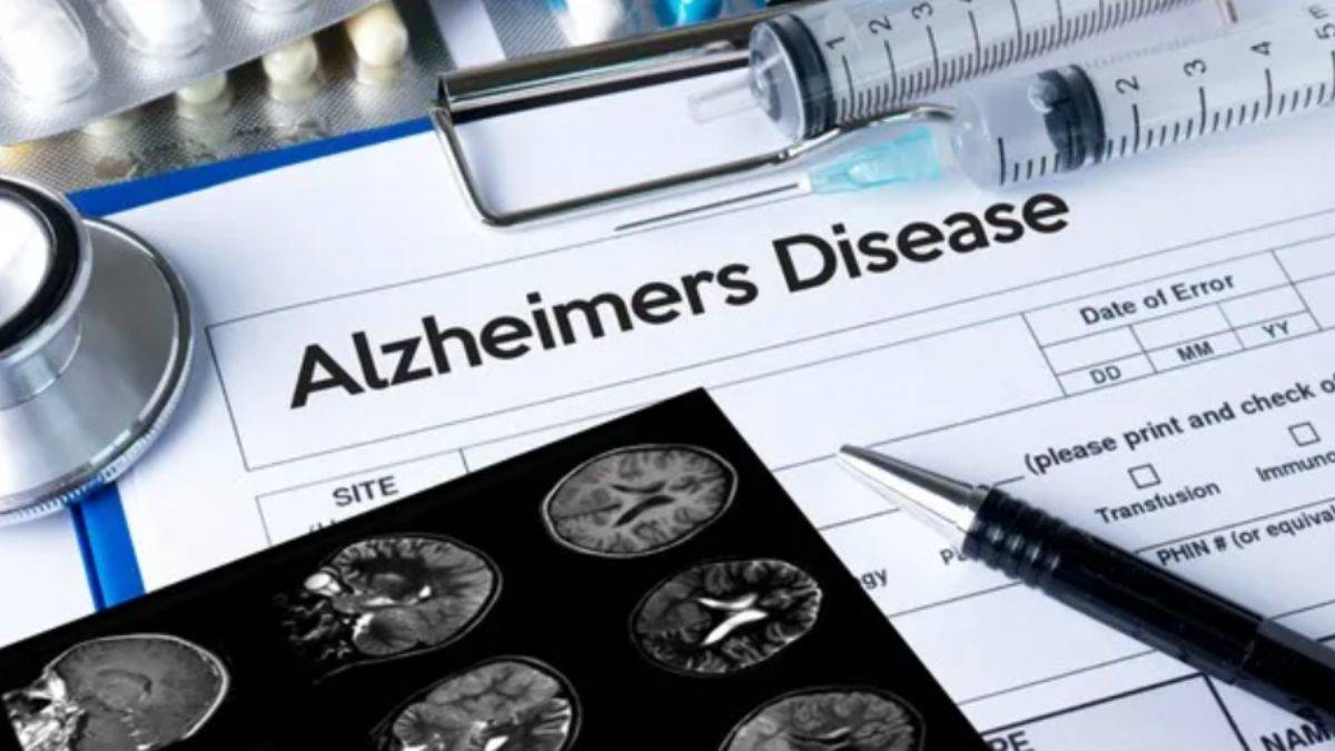 Alzheimer aşısında yeni gelişme