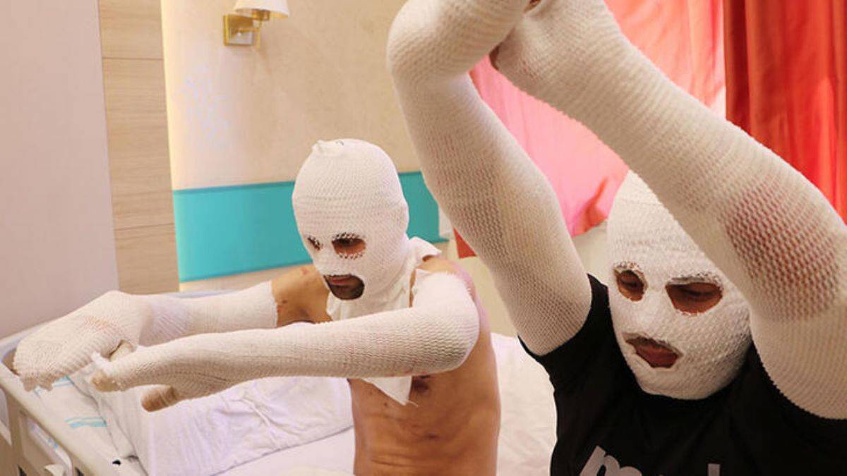 'Sigara yaktık, o sırada patladı'