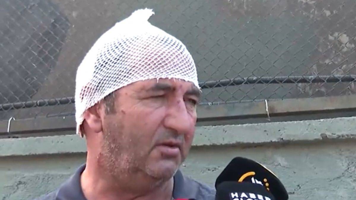 Derince TMO'daki patlamada yaralı kurtulan işçi yaşananları anlattı