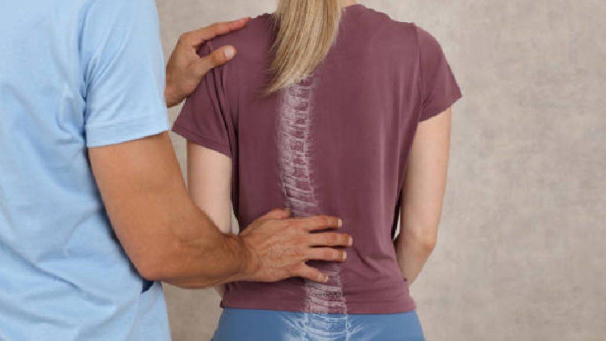 Skolyoz hastalığında kız çocukları daha yoğun risk altında