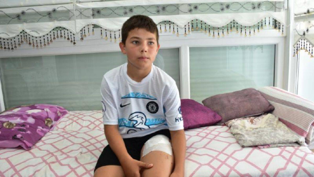 Başıboş köpeğin saldırdığı çocuğun annesinden mesaj