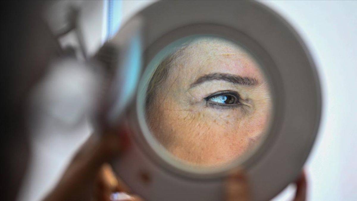 Cilt rengiyle ilişkili 135 yeni gen bulundu