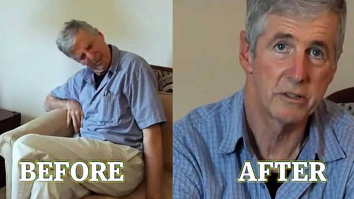 Tıbbi kenevirin Parkinson hastası üzerindeki şaşırtan etkisi