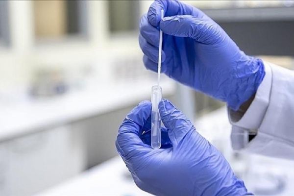 ABD ve bazı Avrupa ülkelerinde görülen Eris varyantına ilişkin Türkiye'den açıklama