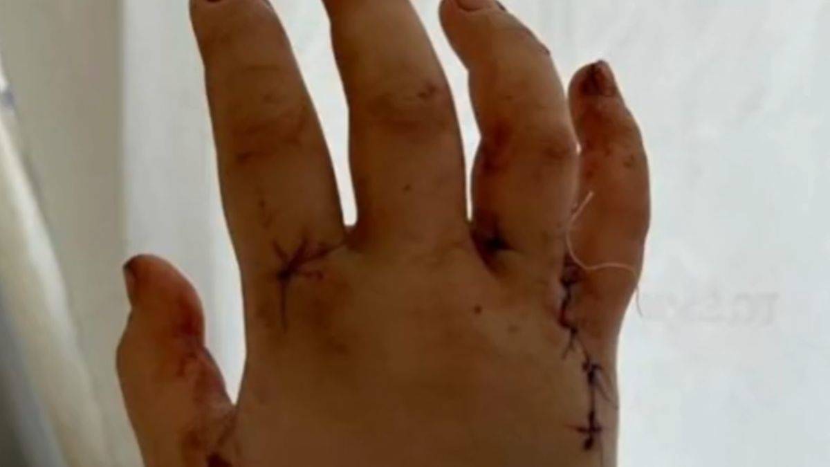 32 yerinden bıçaklanan youtuberdan ilk paylaşım