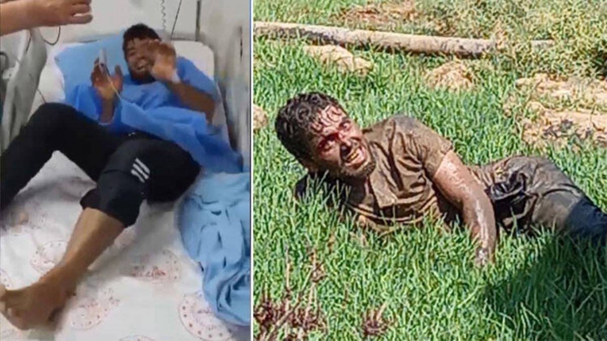 Kuduz tedavisi için ikna edilmişti, hastanede öldü