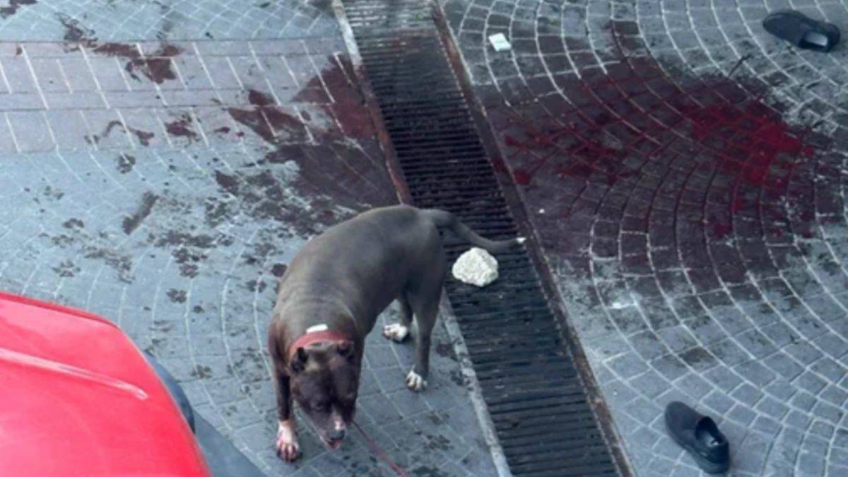 Pitbull köpeği saldırdı, ortalık kan gölüne döndü!