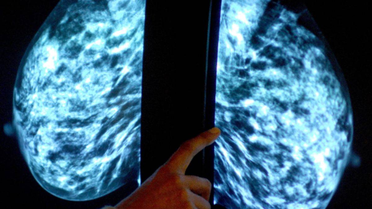 Kanserin '1 numaralı' ilacı