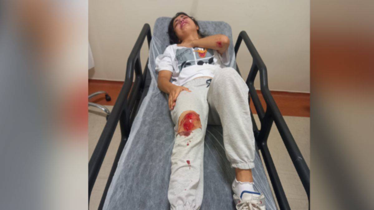 Köpeklerin saldırısından kaçarken yaralandı