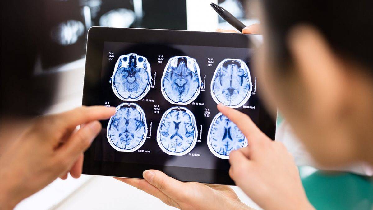 Yapay zeka beyne girdi!