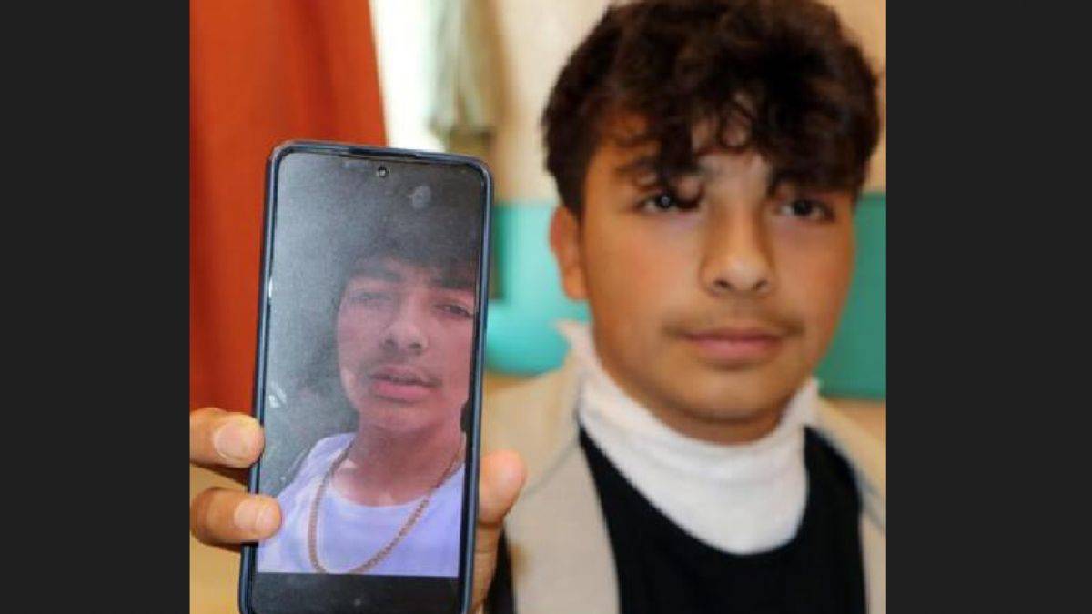 Yıldırım çarpan gencin kolyesi parçalandı