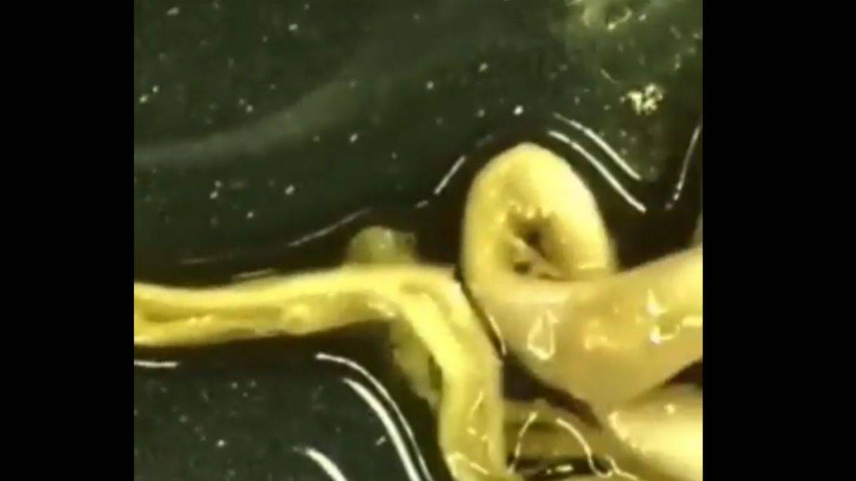 Aşı olanların kanında bulunan ipliksi şey ne?