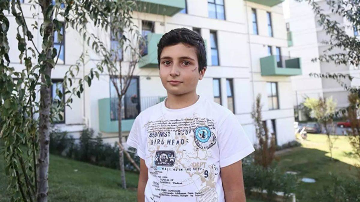 Köpek saldırısında yüzünden yaralandı! Okula gitmek istemiyor