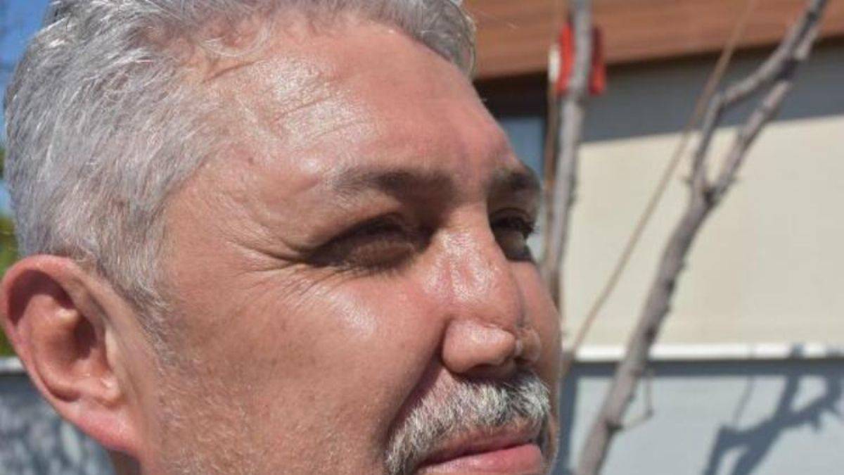 Okul arkadaşı doktor burnunu bu hale getirdi