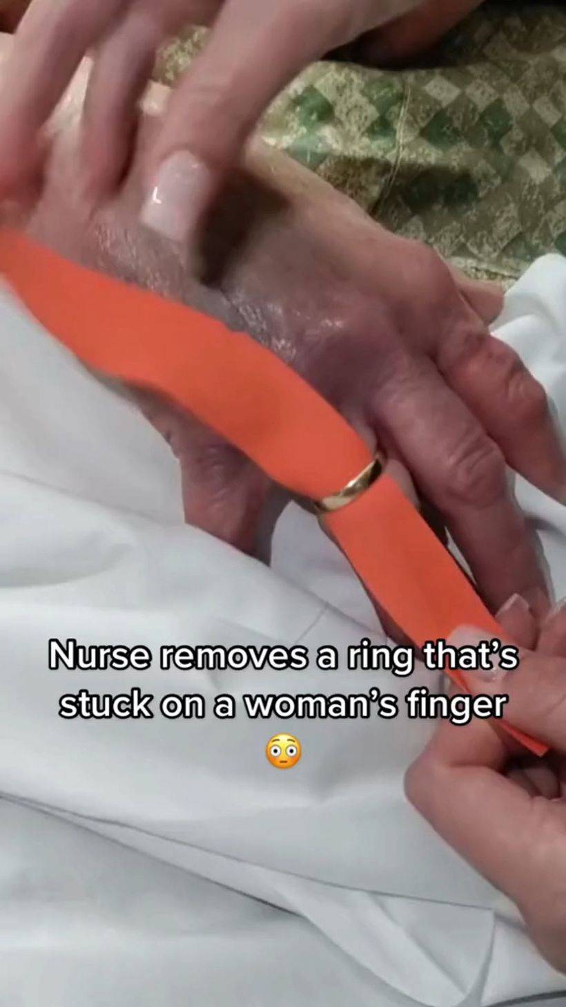 parmağınıza sıkışmış yüzüğü çıkartmanın püf noktası