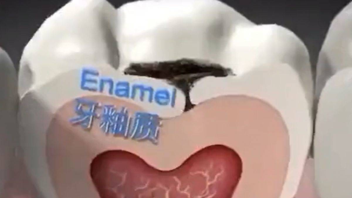 Çürük dişleri eski haline getiren ilaç icat edildi