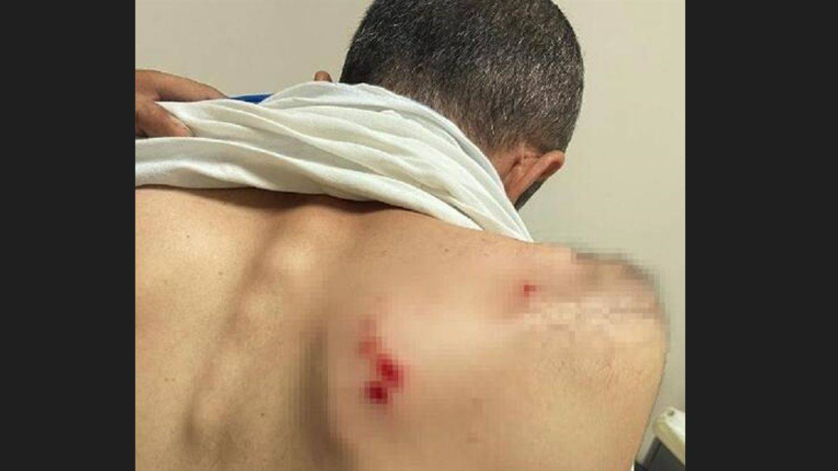 Kaçak elektrik kontrolü yapan ekibe saldırı: 2 yaralı