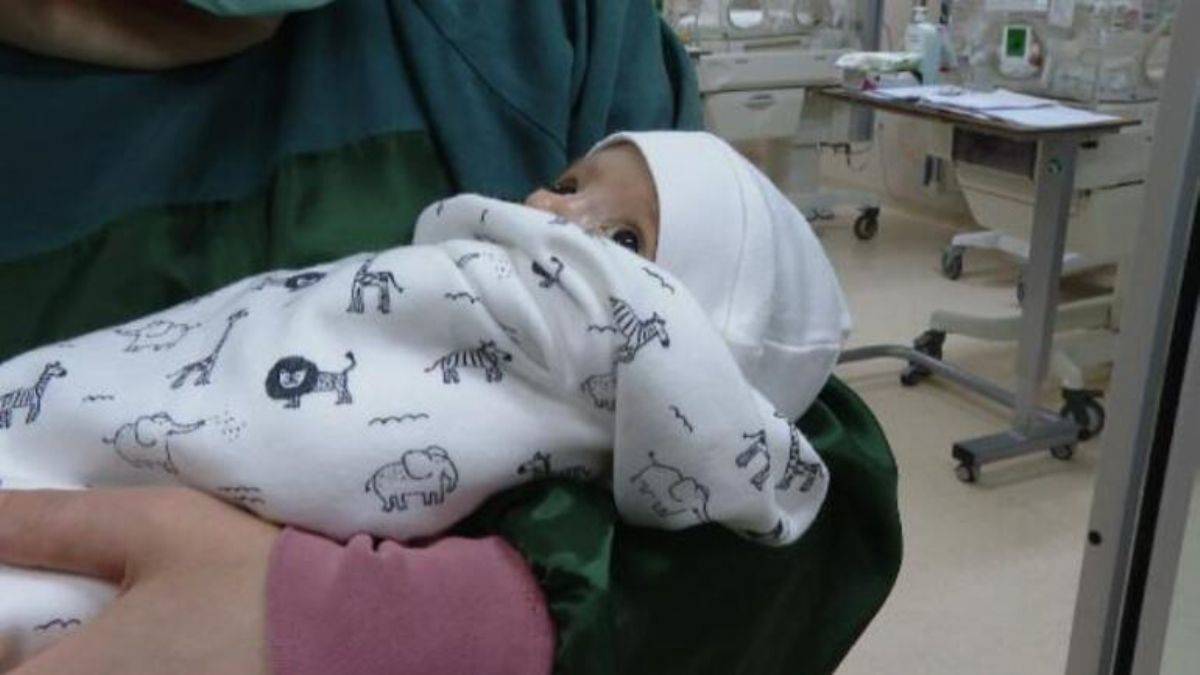 İnce bağırsağı tıkalı doğan bebeğe çifte operasyon