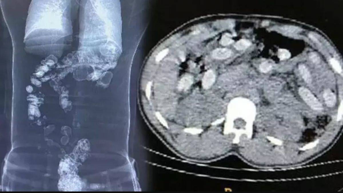 Rize'de 3 İranlı kadın uyuşturucu ile yakalandı