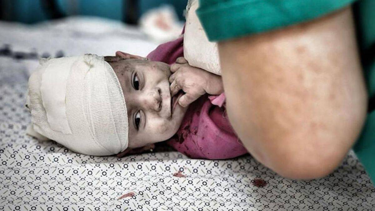Gazze'de yaralanan bebeklerin hali yürek yaktı