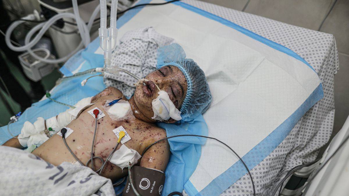 Gazze'deki doktorların mücadelesi