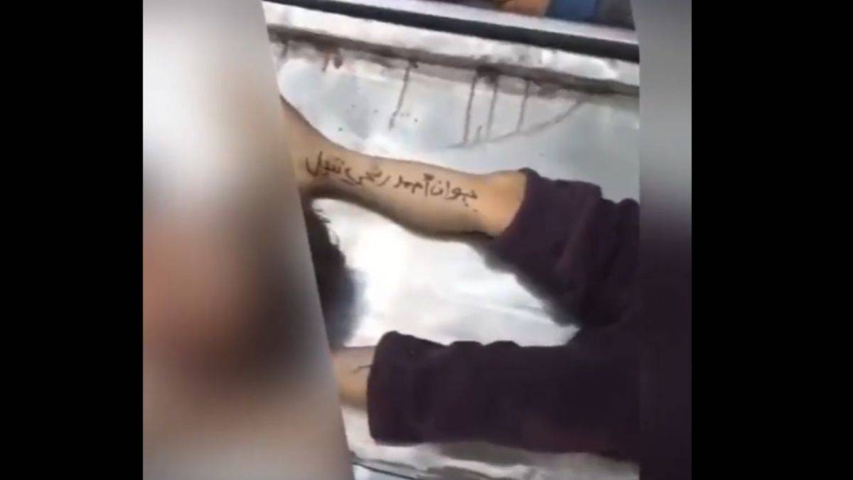 Gazzeli çocukların isimleri bacaklarına yazılıyor