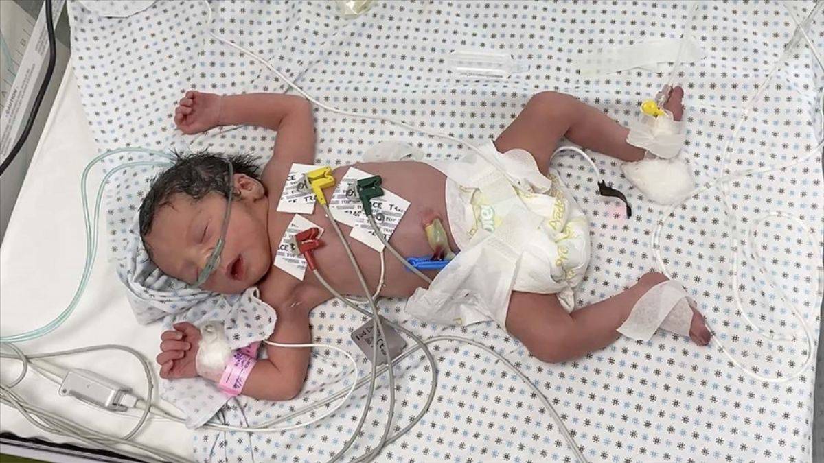 Gazze mucizesi: Şehit annenin karnındaki bebek