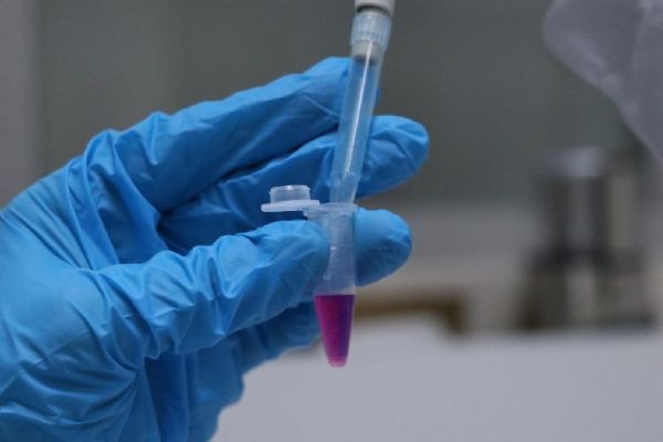 Türk bilim insanlarının kanserli hücrelere ''nanoparçacıklar'' ile uyguladığı radyoterapi olumlu sonuç verdi