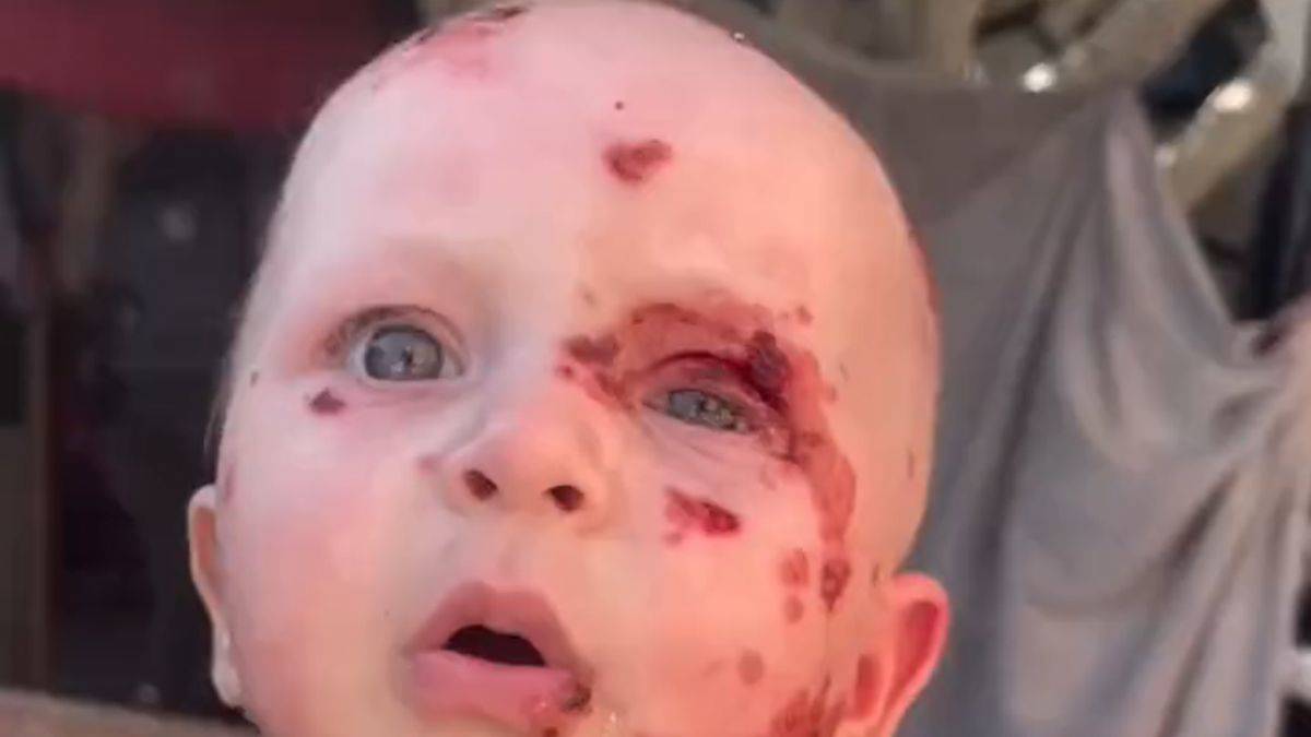 Gazzeli Mira bebek İsrail saldırısında yaralandı