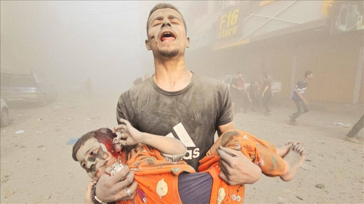 1000 Filistinli yaralı çocuk BAE yolcusu