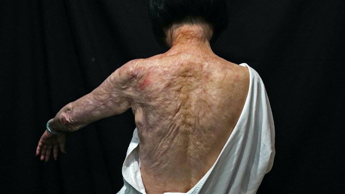 Ünlü fotoğrafçı Ut: Bu savaş, Vietnam Savaşı'ndan çok daha tehlikeli