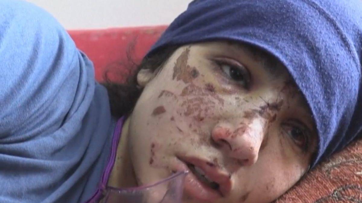 İsrail saldırısında bacaklarını kaybeden çocuklar: 'Kendi bacaklarımı istiyorum'