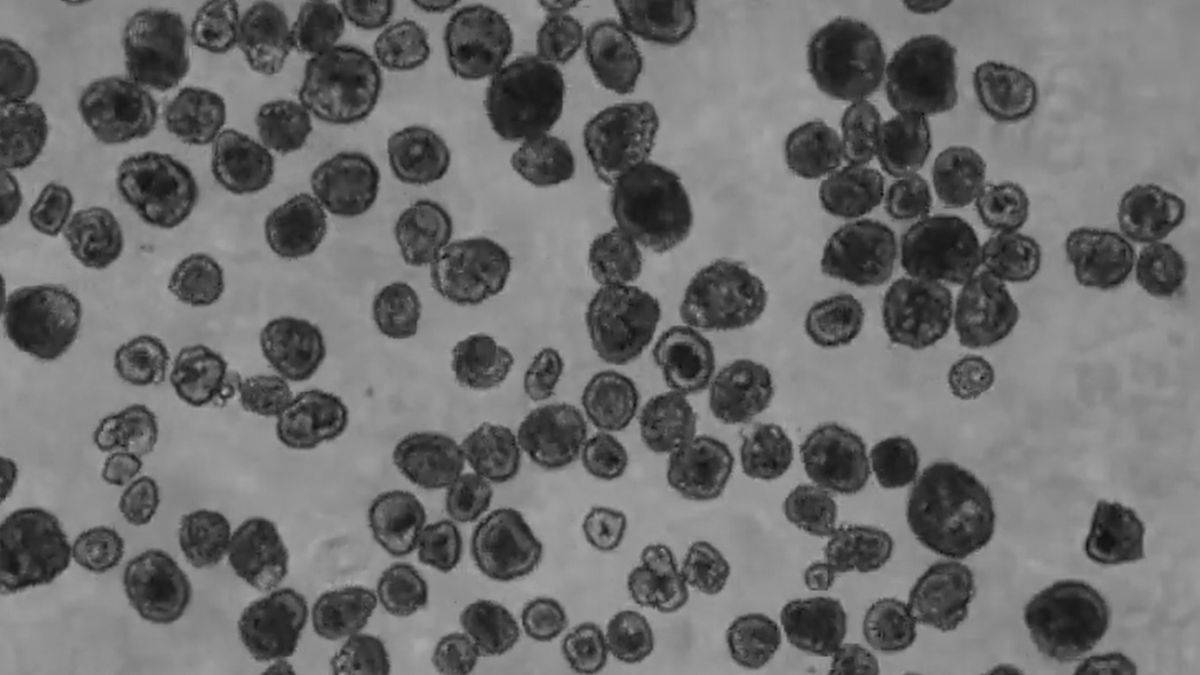 Yara ve hasarlı dokular için canlı minik robot üretildi