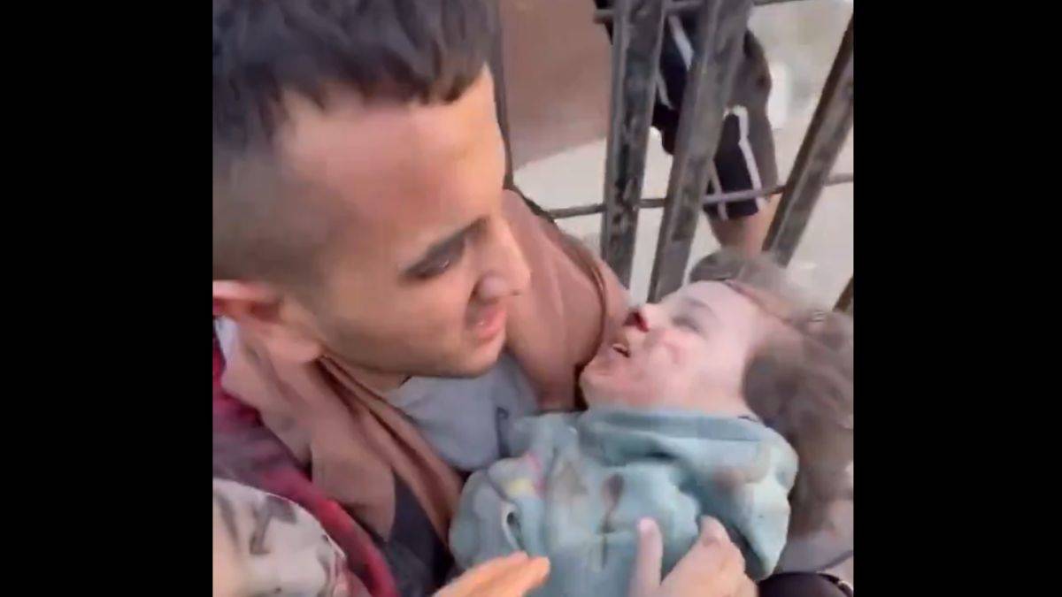 İsrail saldırılarında yaralanan çocuklar hastaneye böyle yetiştiriliyor