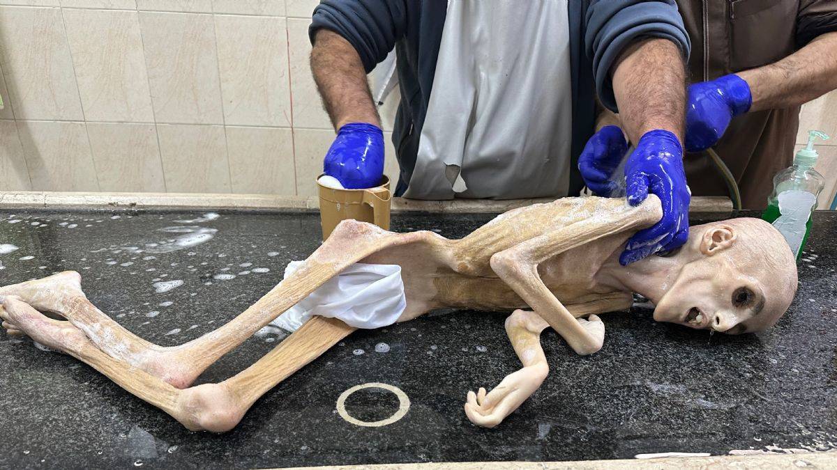 Dünya seyrediyor! İsrail, 151 günde 13 bin 430 çocuk öldürdü