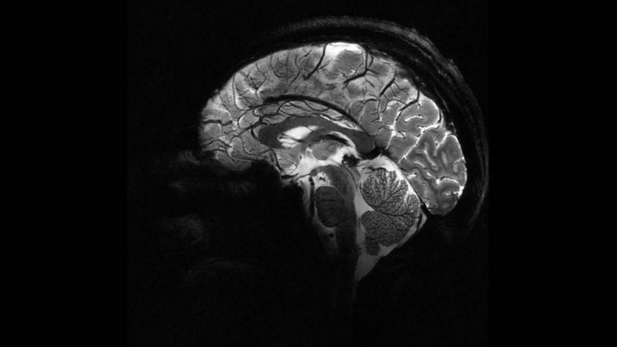 En güçlü MRI cihazında insan beyninin en net görüntüsü çekildi