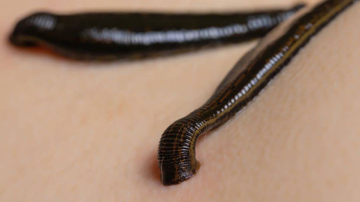 Tıp dünyasında yeni cihaz; Sülüklerden ilham alındı