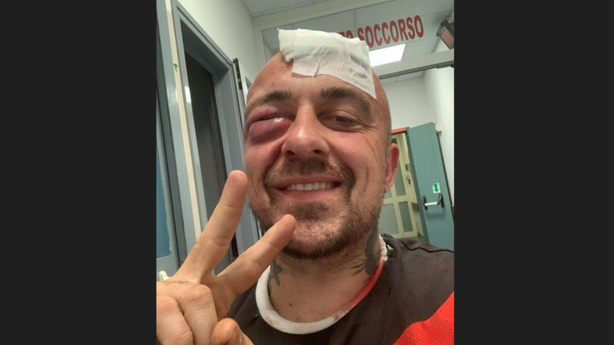 Ünlü İtalyan şef, 6 Yahudinin saldırısını kanlar içinde anlattı