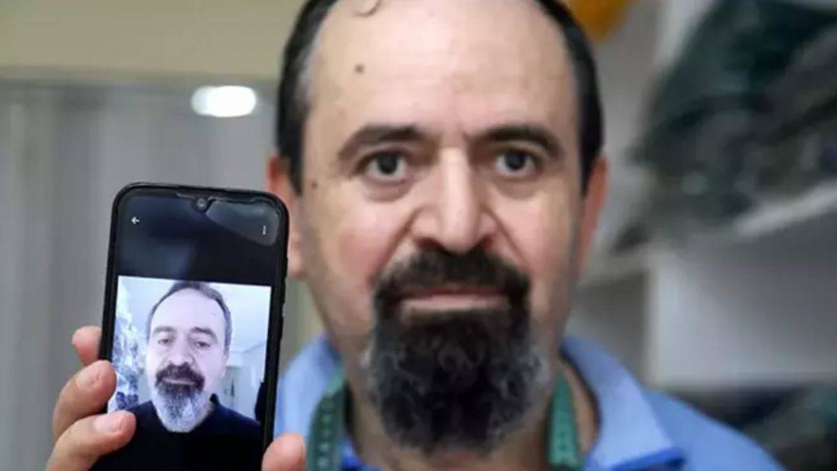 Kanser tedavisinden sonra beyaz saçı ve sakalı siyah uzadı