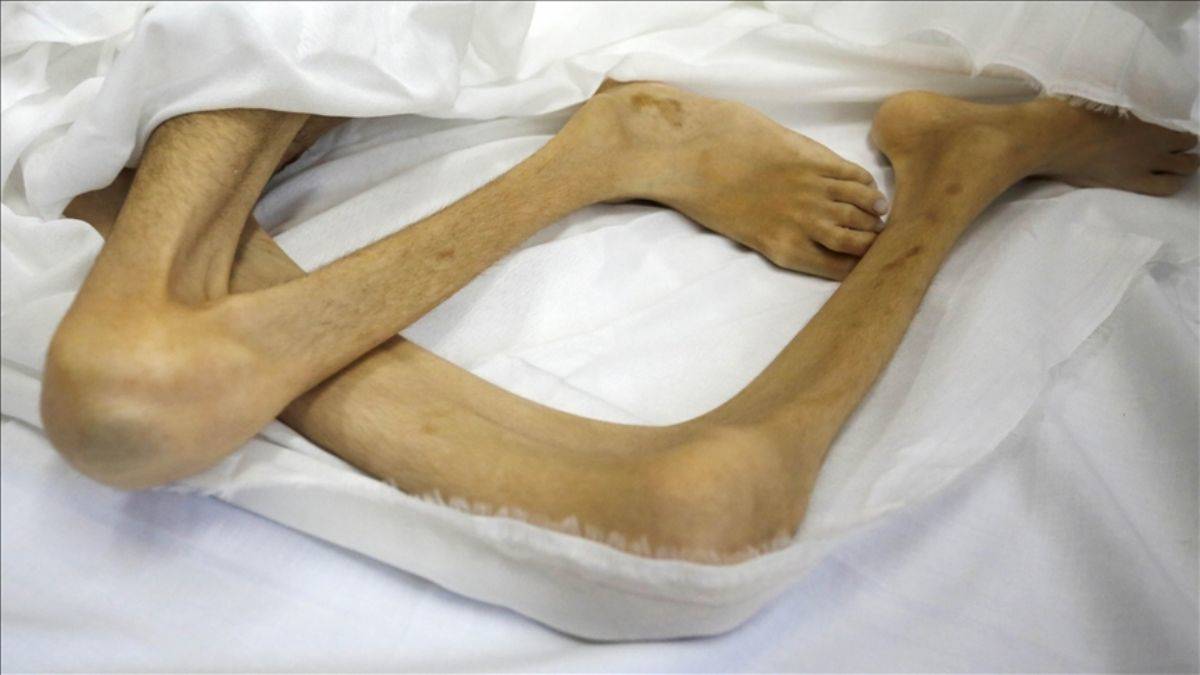 Gazze'de İsrail soykırımı: 3 bin 500'den fazla çocuk ölecek!