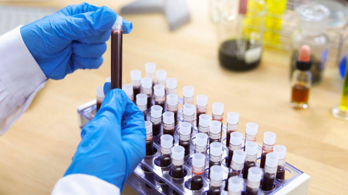 Binlerce İngiliz'in kan testi sonuçları çalındı