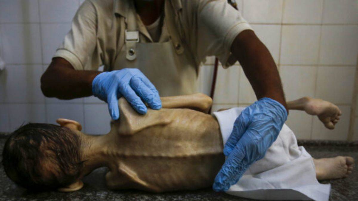 Bir çocuk daha açlıktan öldü...